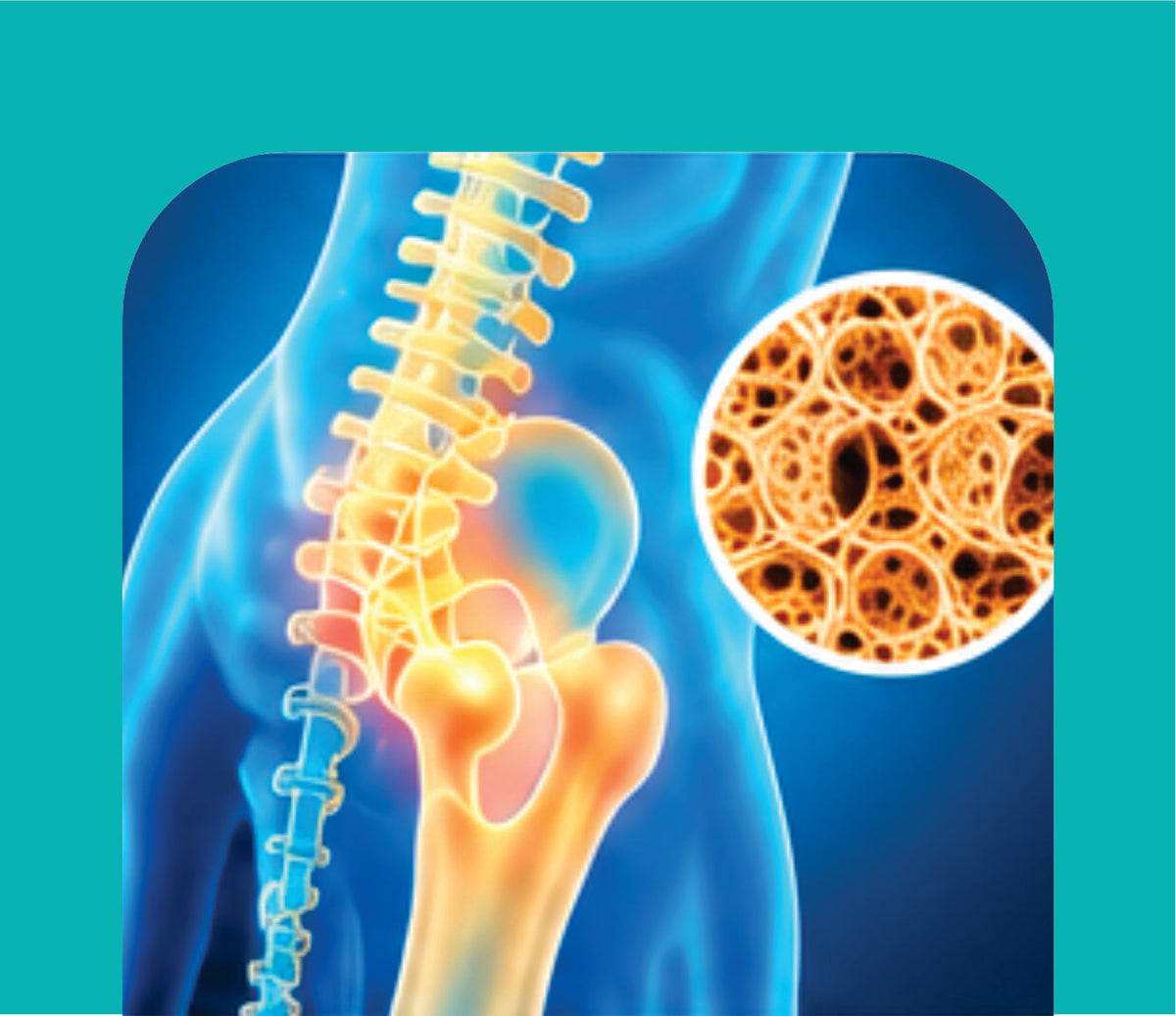 BONE HEALTH & OSTEOPOROSIS