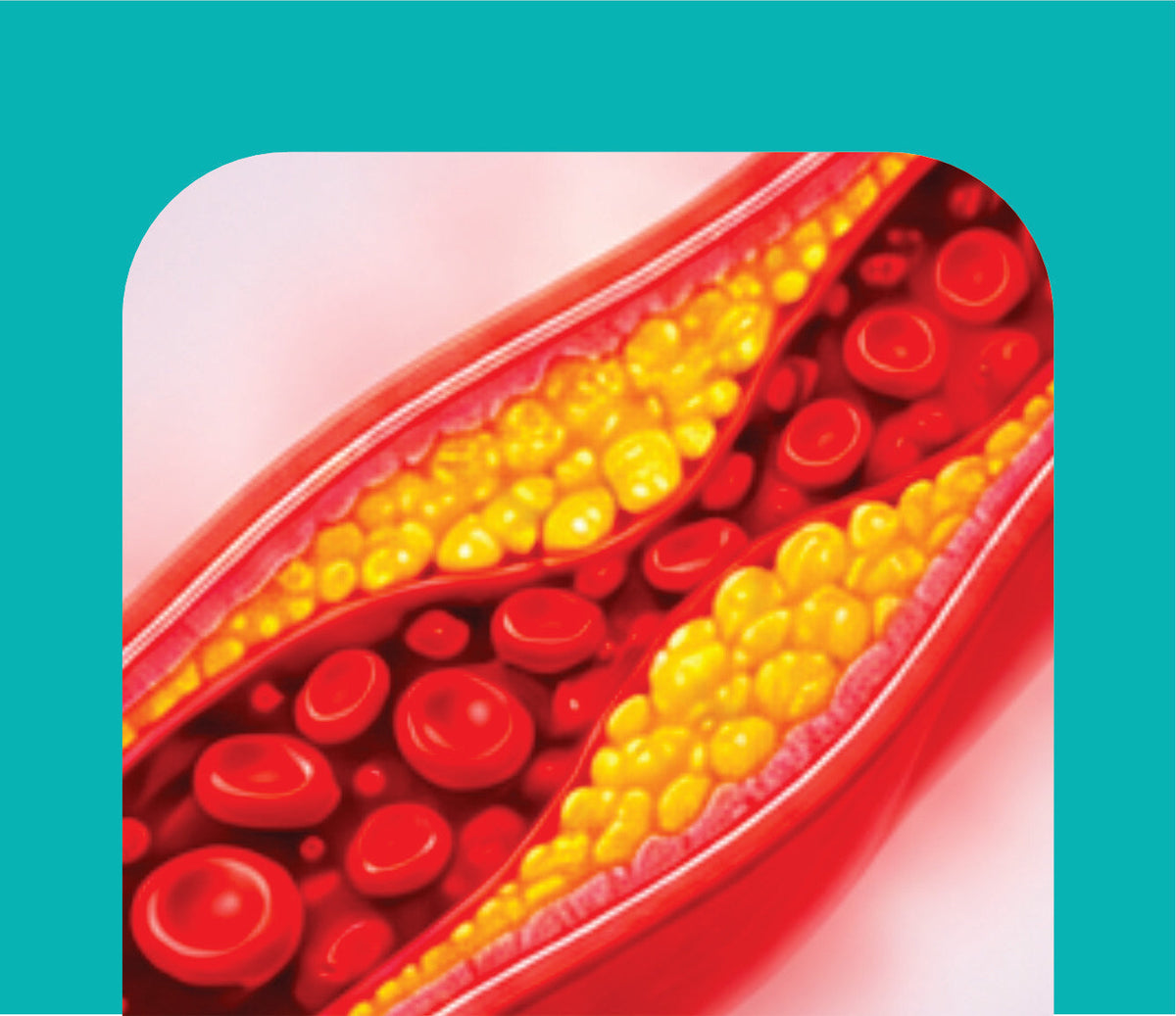 CHOLESTEROL CARE