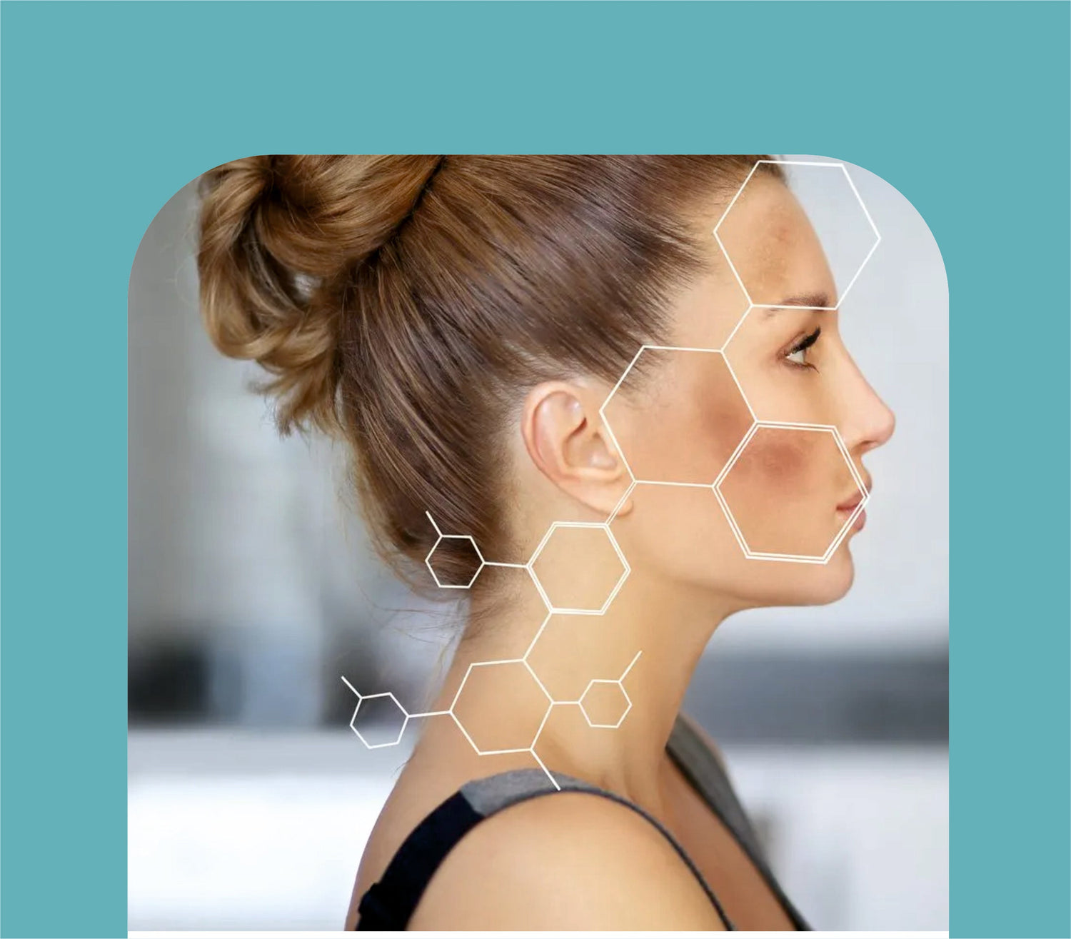 PIGMENTATION & BRIGHTENING